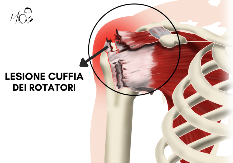 Allargatore Pneumatico Per Giunto Omocinetico - Espansore Gomma CV Ergonomico | Attrezzo Antiscivolo Resistente Per Guarnizione Auto, Riparazione Gabbia A Sfera Esterna E Officina Meccanica