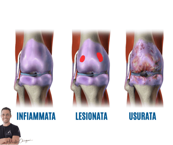cartilagine ginocchio nutrizione naturale