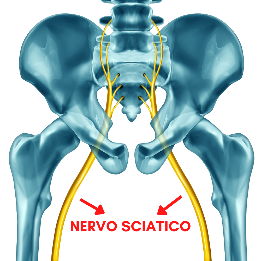 sciatica mozza