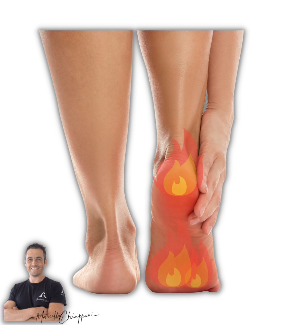 fibromialgia e bruciore ai piedi