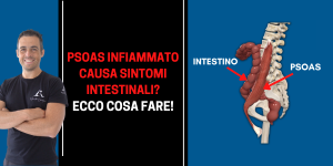 psoas infiammato