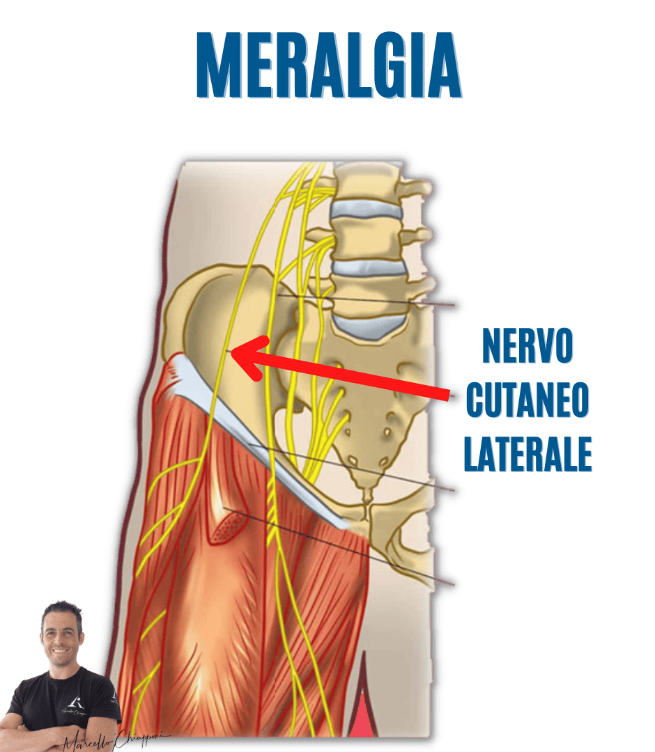 dolore esterno coscia