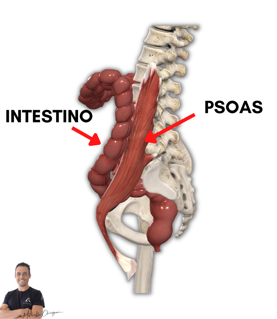 infiammazione psoas