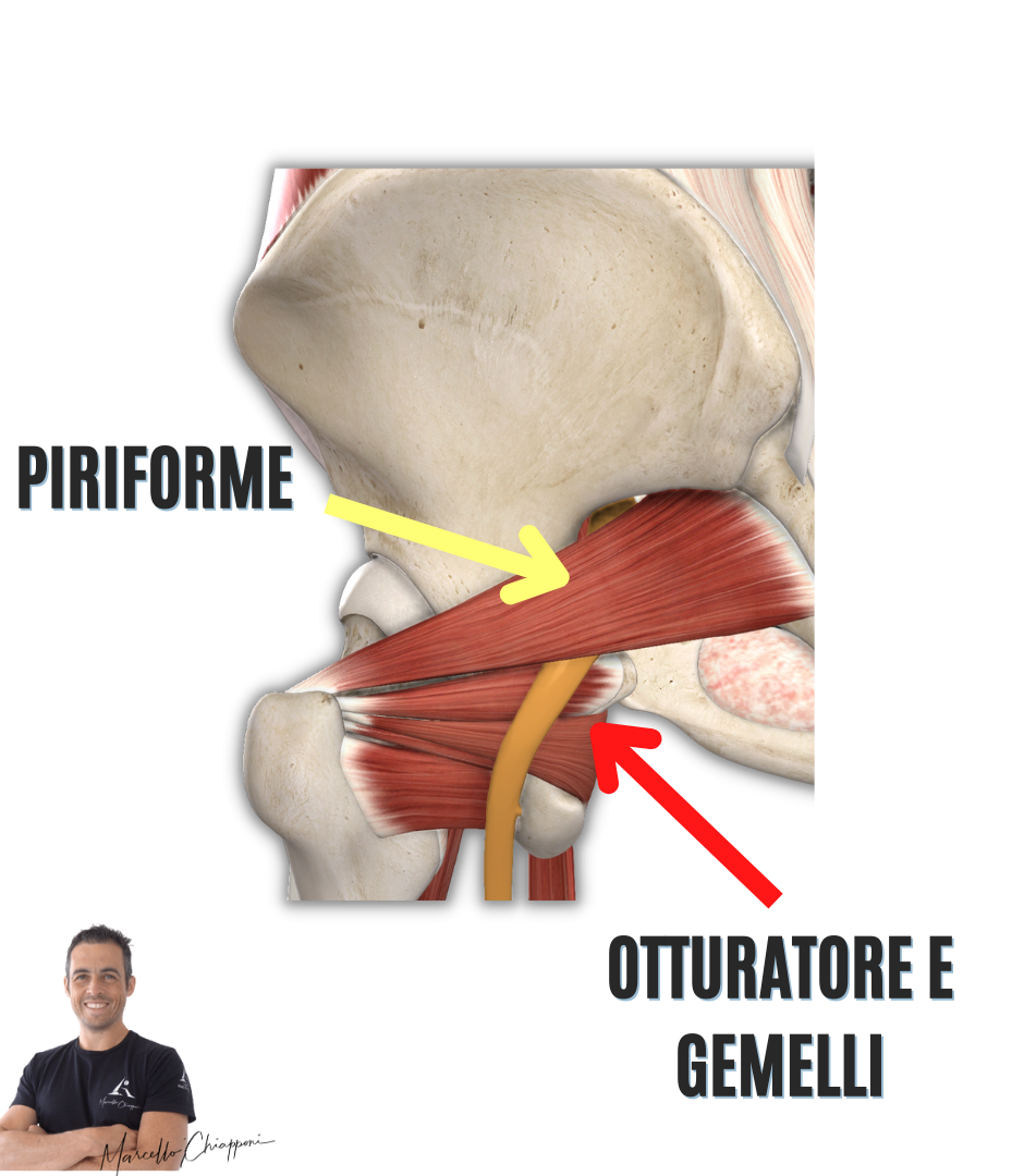 sindrome del piriforme