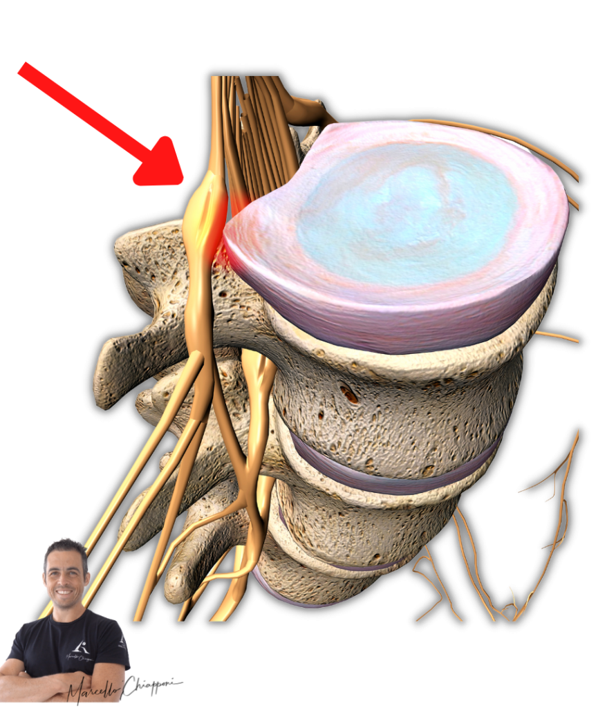 Cervicale e formicolio alle mani