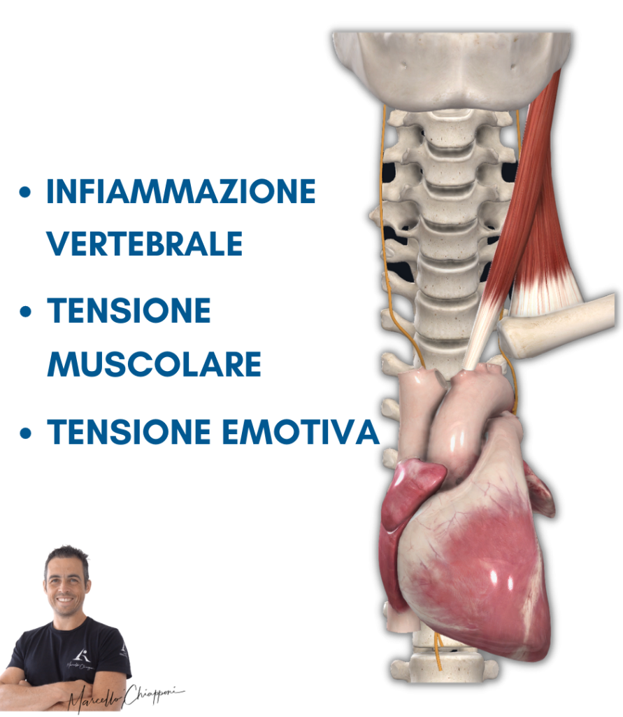 Tachicardia cervicale