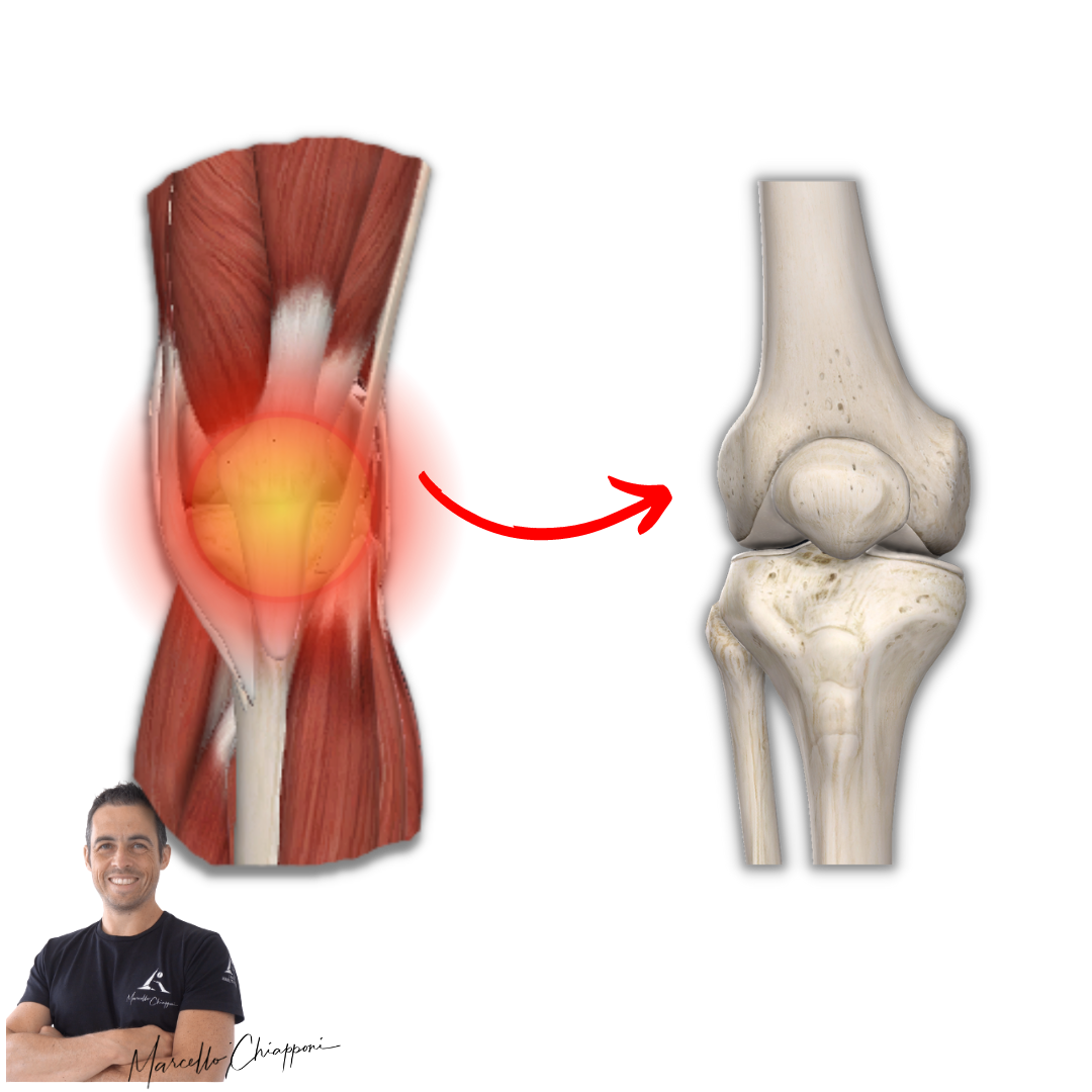 Dolore dentro al ginocchio ma senza gonfiore
