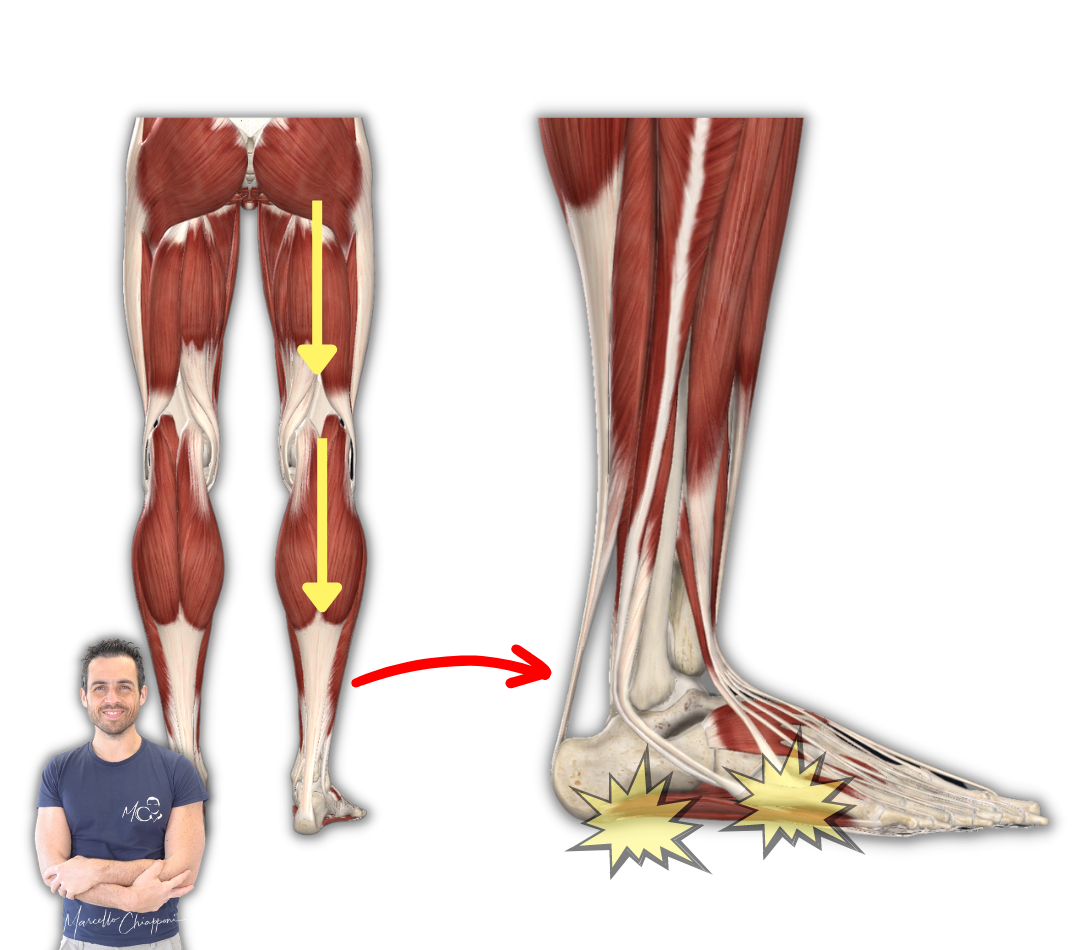 Fascite plantare e muscoli della gamba