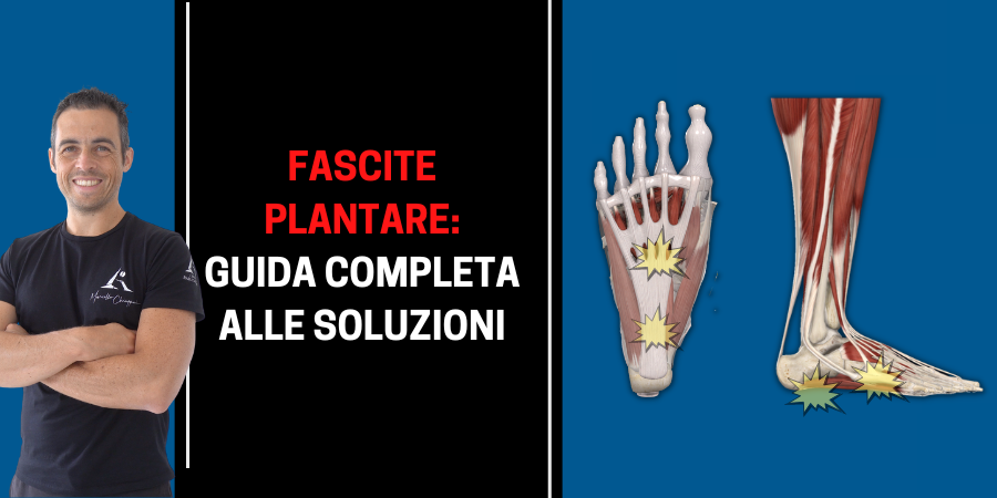 Fascite plantare: guida completa alle soluzioni (agg. 2023)