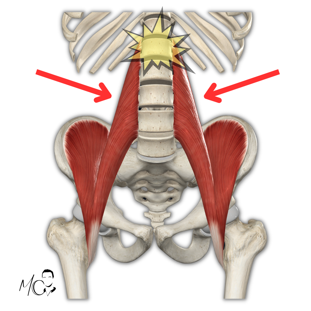 psoas e postura