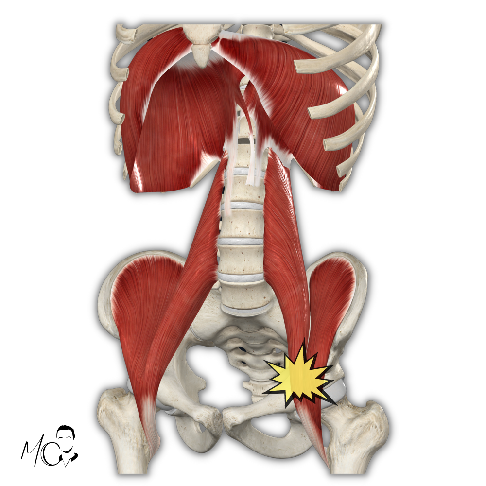 Psoas e dolore all'inguine