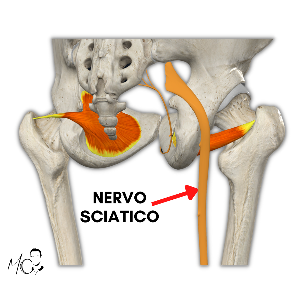 psoas e nervo sciatico