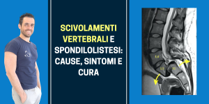 scivolamenti vertebrali e spondilolistesi