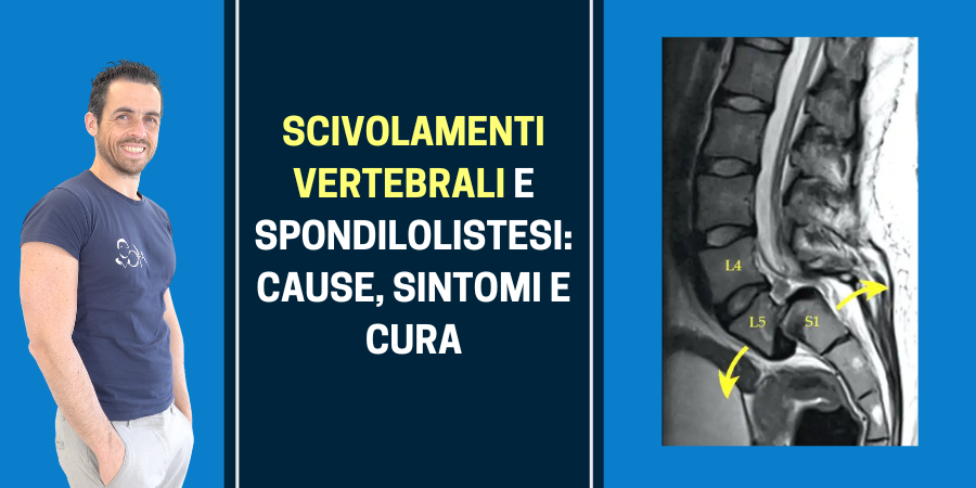 Scivolamenti vertebrali e spondilolistesi: cause, sintomi e cura