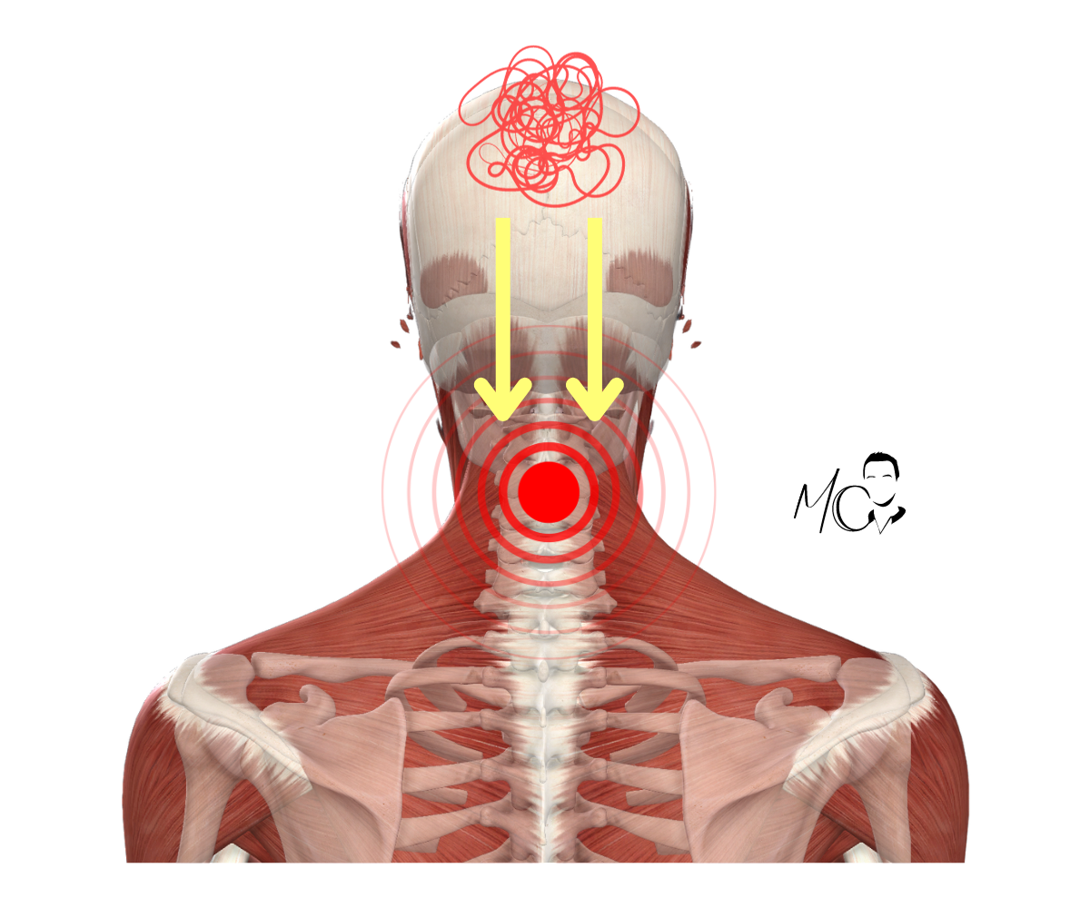 Perché la cervicale può creare problemi a clavicola, petto e torace