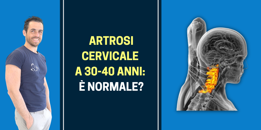 Artrosi cervicale a 30-40 anni: è normale?