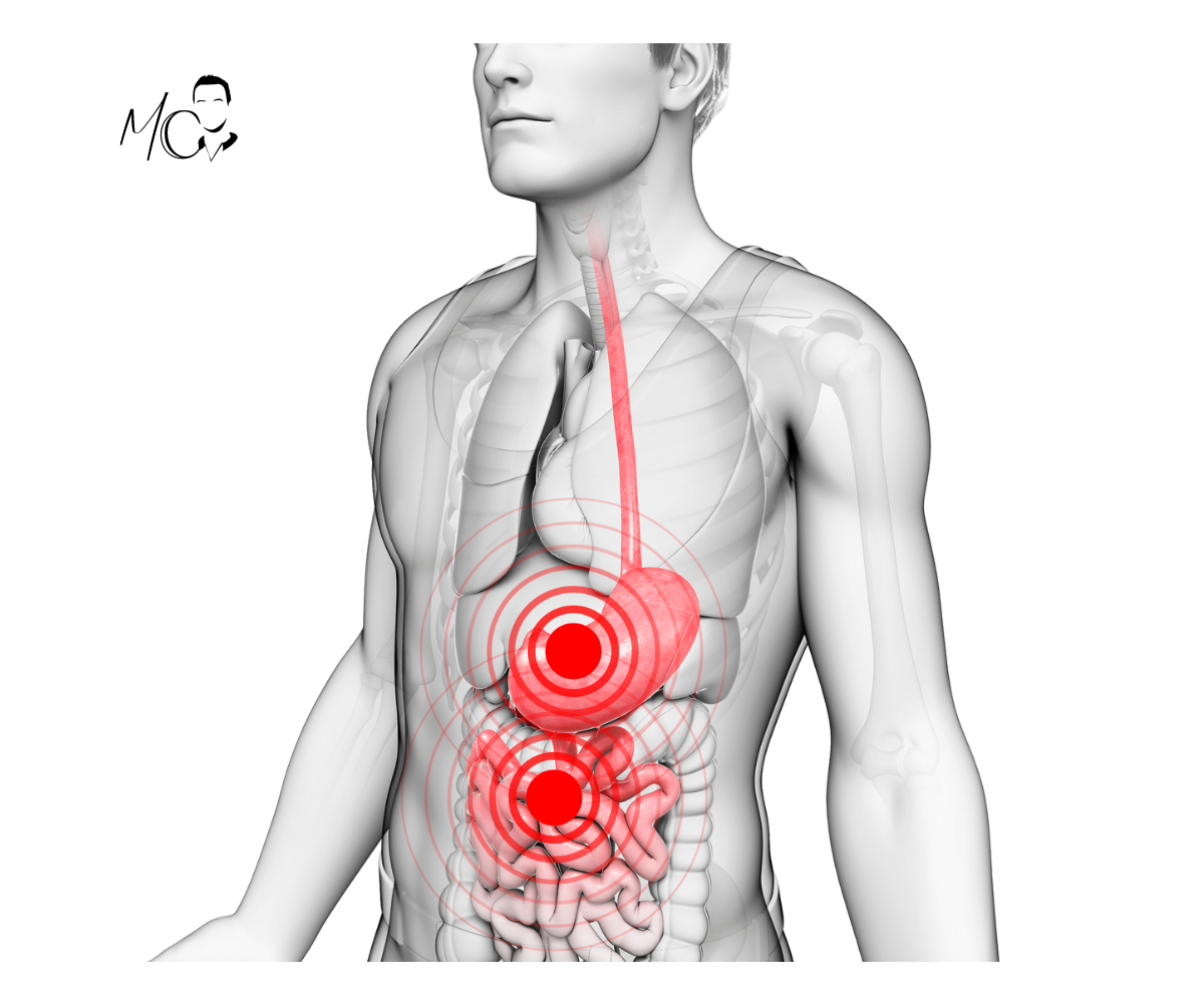 Gonfiori di stomaco e intestino