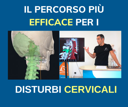 cs2